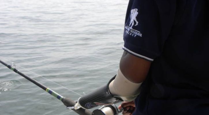 A person with a prosthetic arm holding a fishing rod over the water.