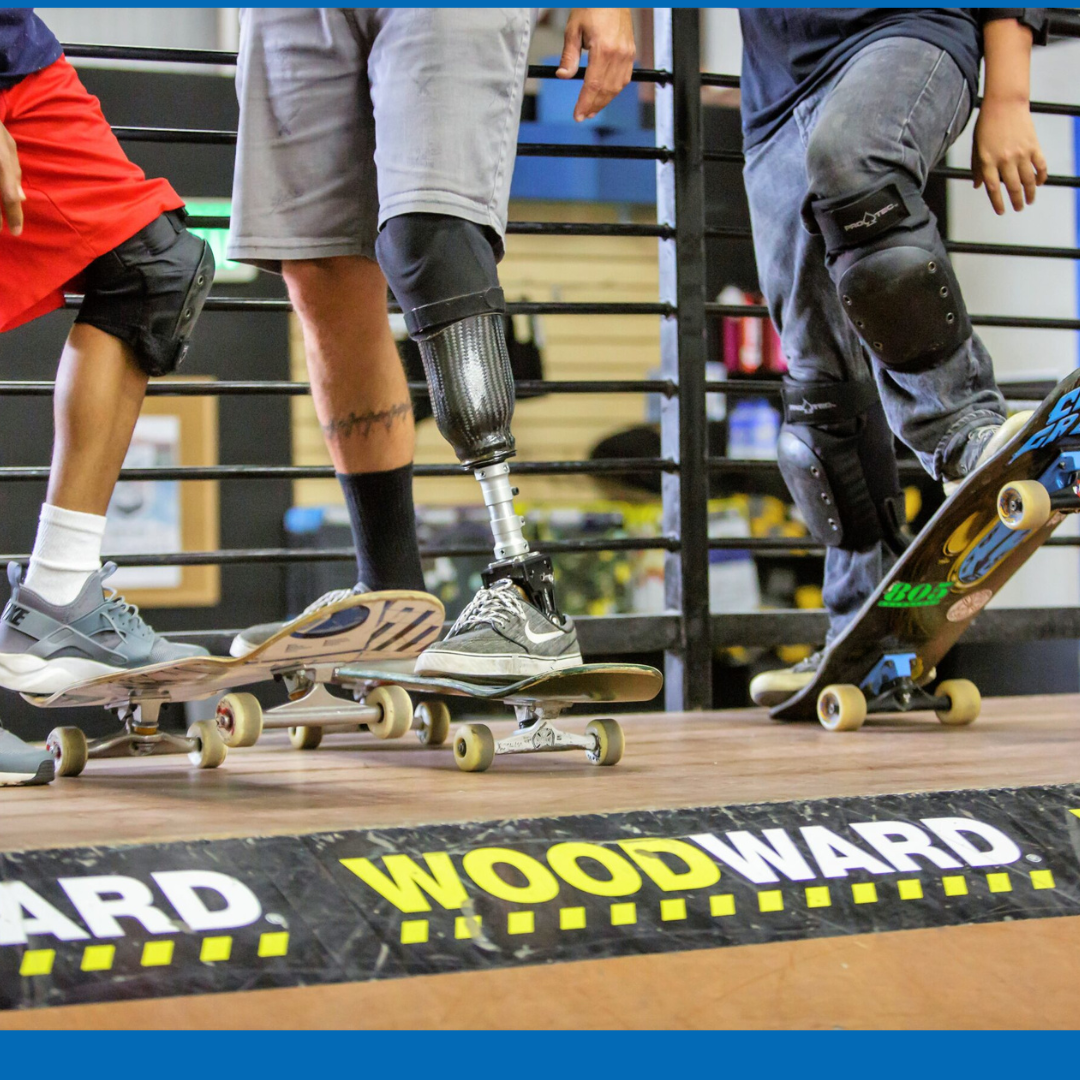 close up of peoples feet, some fully abled, others with prosthetics and all standing on skateboards about to go down a ramp